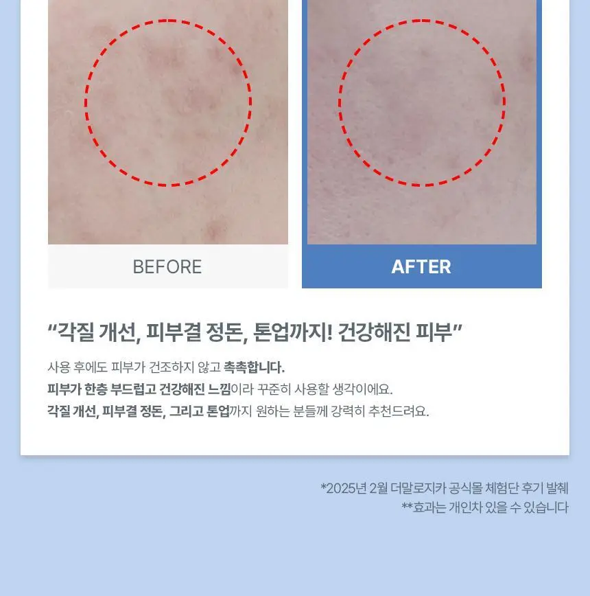[심톨 PICK] [데일리/각질진정] 더말로지카 데일리 마이크로폴리언트 74G 상세페이지 21